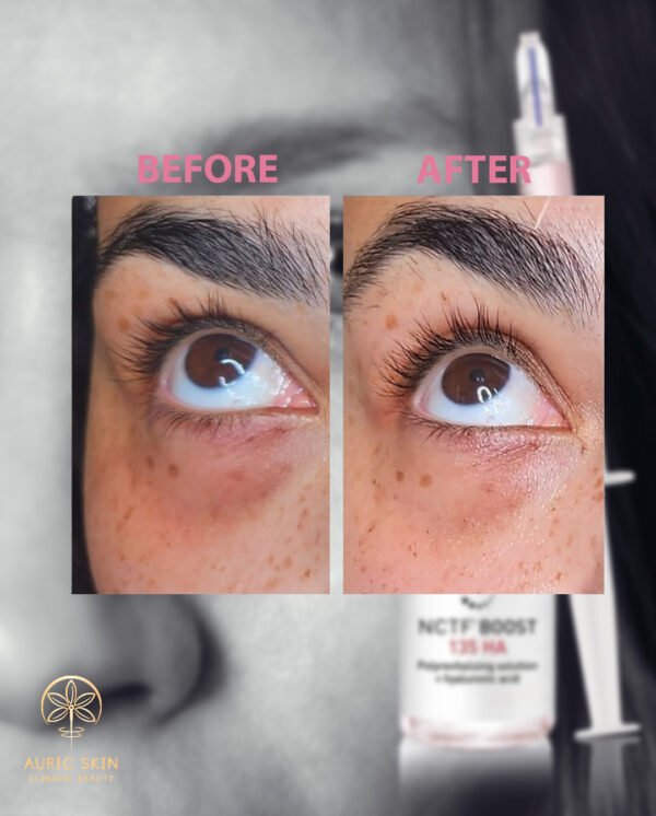 NCTF-Before-and-after-image-01