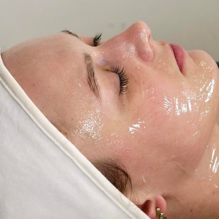 Chemical-Peels-Unveiling-a-Fresh-Layer-of-Skin