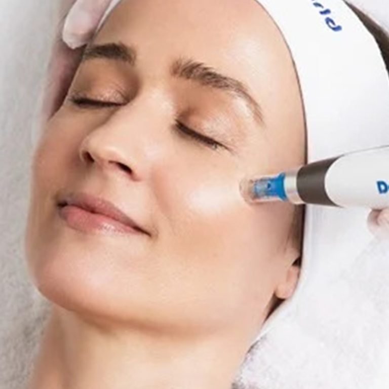 Microneedling01